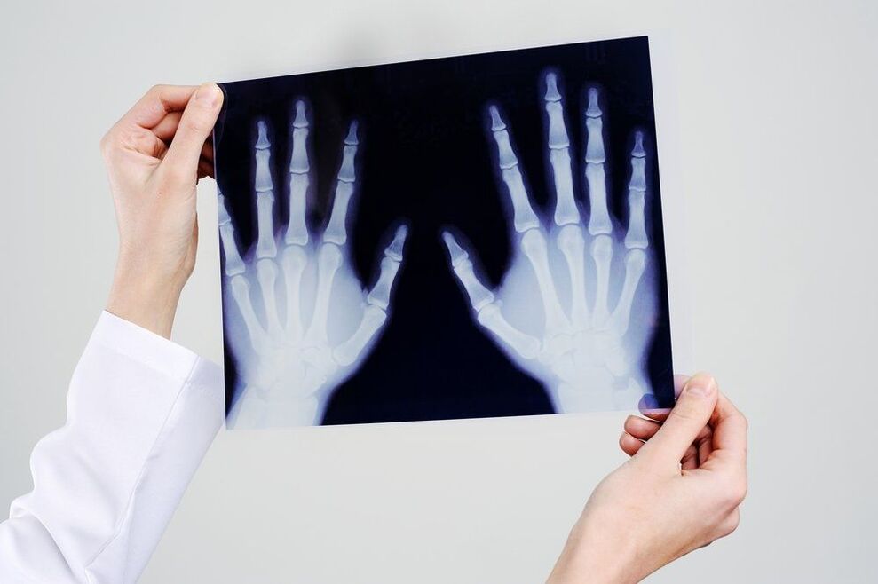 diagnostica dell'articolazione della mano